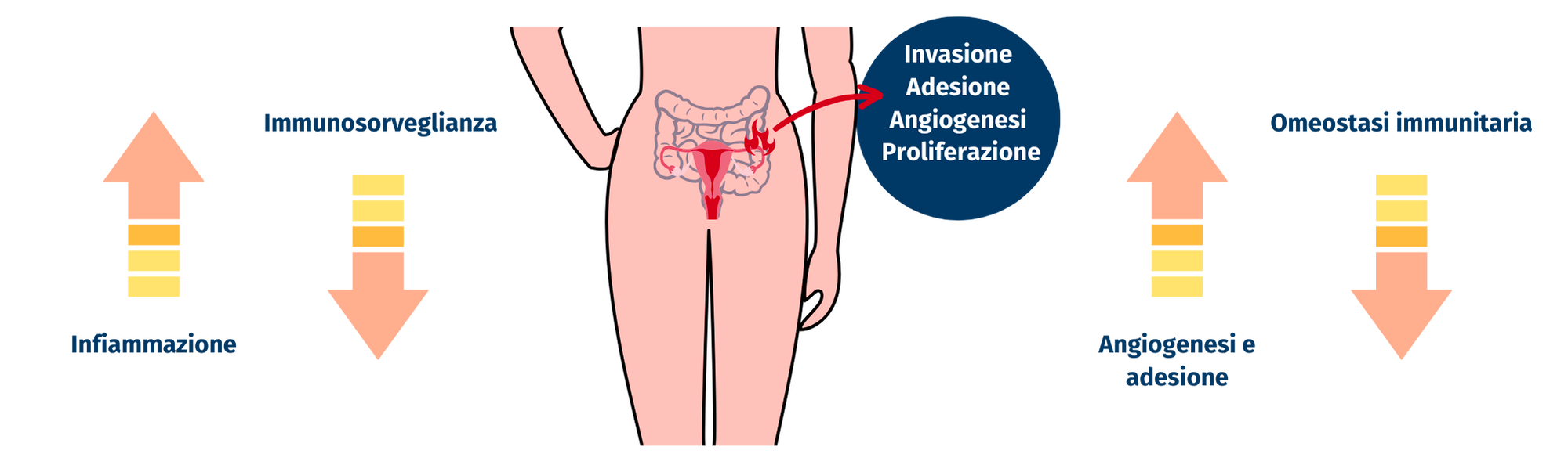 microbiota intestinale nell' endometriosi